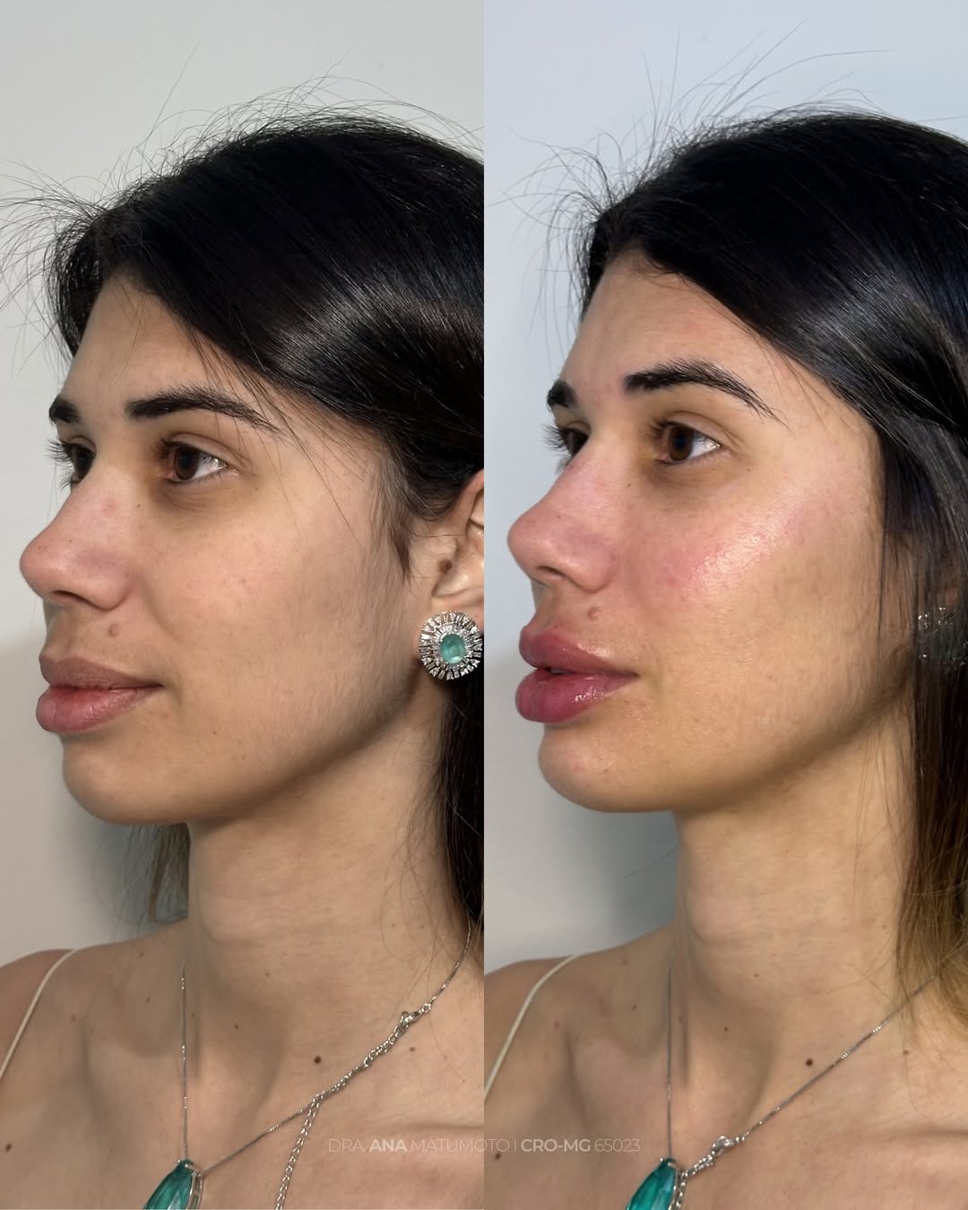 Antes e depois — caso 7